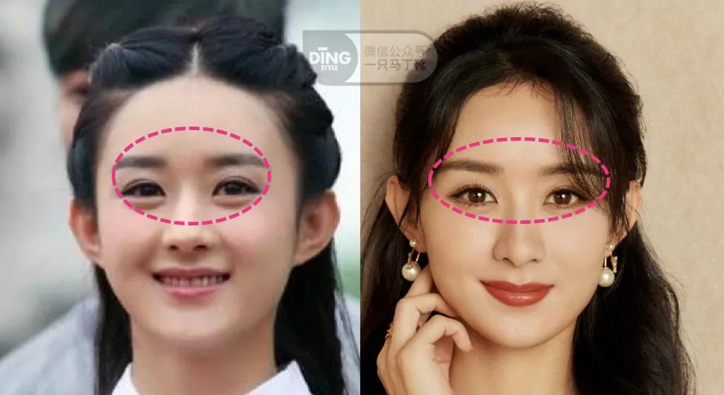 大方形脸女生变美思路,脸大脸圆怎么变美