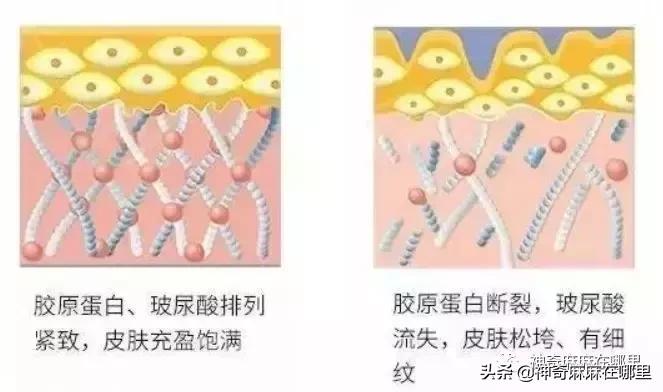 bbc珍珠面霜 (bbc沙棘面霜)