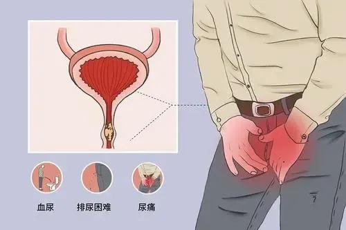 有些“肚子疼”延误不得，你需要了解这些知识