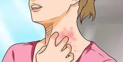 荨麻疹痒的睡不着有什么办法止痒,荨麻疹太痒了可以冷敷吗