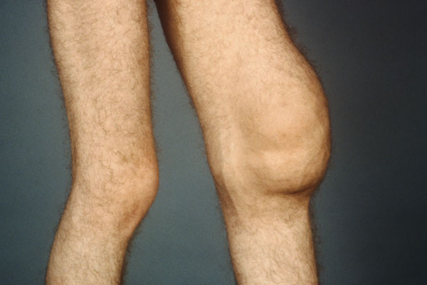 氨糖能在网上买吗怎么找正品,氨糖购买