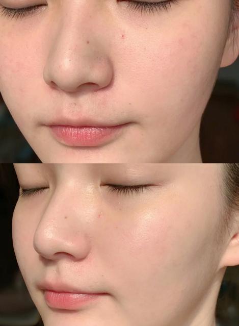 张馨予李佳琦面霜,张馨予李佳琦面膜