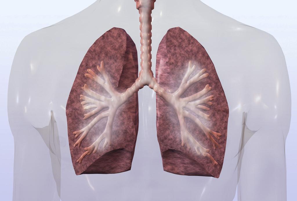 放射性肺炎的诊断与治疗进展,放射性肺炎的主要治疗措施是