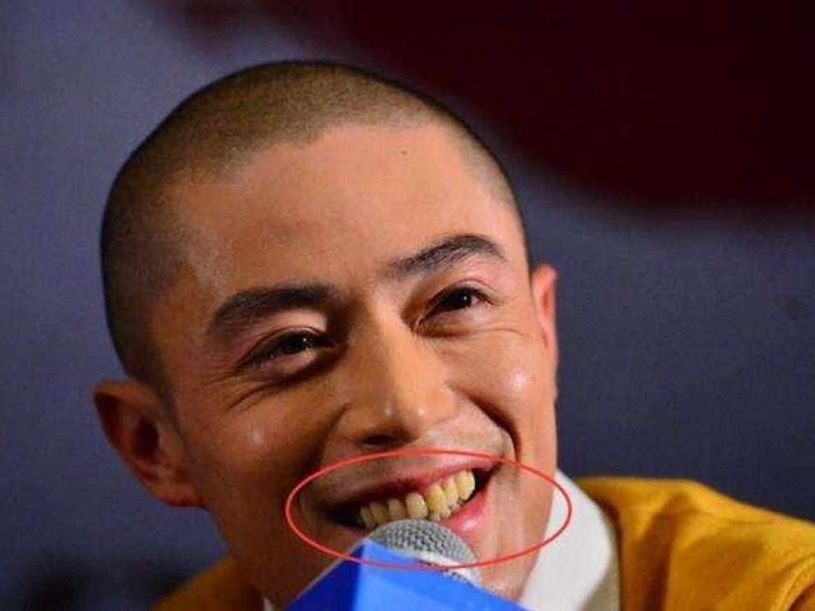 最低调“国宝级”牙膏，因价低无人过问，用后终于没有牙黄牙渍了