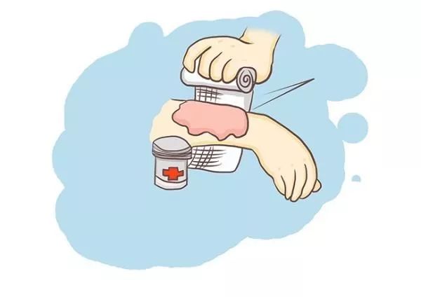 新生儿烫伤原因,意外伤害烫伤应急预案