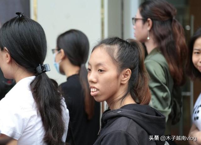 越南女性整容前后,越南姑娘整容成富二代