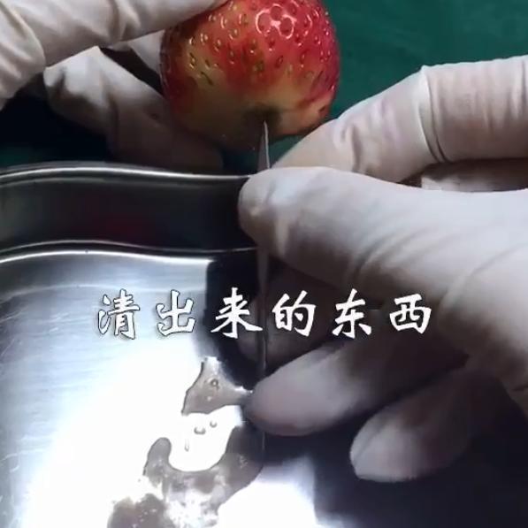 人流危害很大女孩子要保护自己,人流伤害达到几级痛