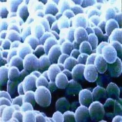 酵素排毒科普,酵素减肥原理和方法有哪些