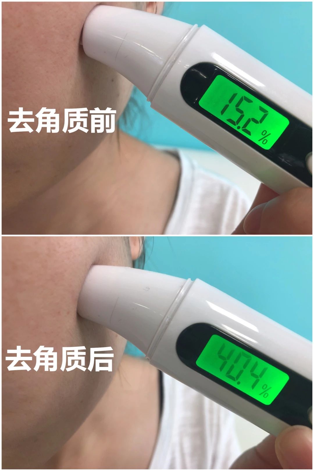 孙艺珍的颜值变化,孙艺珍颜值巅峰的笑容