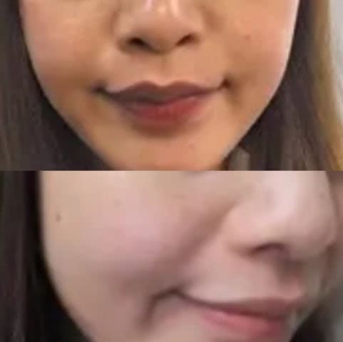 淡斑祛痘印什么产品最有效,淡斑美白祛痘印