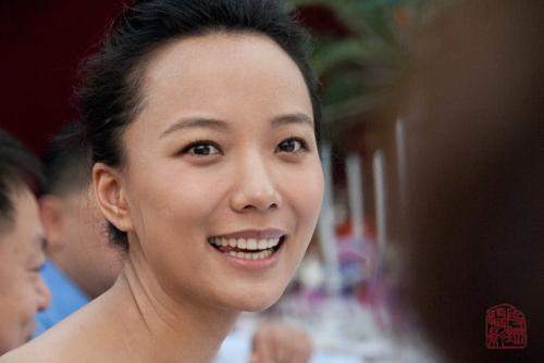 陈奕迅秃顶头发稀疏,陈奕迅同款发际线怎么补救