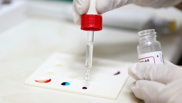 新型药物Gammora给消灭艾滋病病毒带来希望