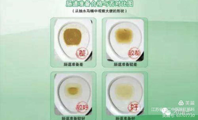 做肠镜检查前做什么准备儿童,无痛肠镜检查前肠道准备