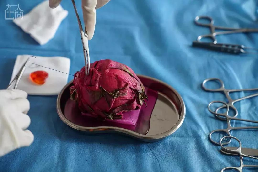 我在快手上看人切洋葱，竟然弄懂了剖腹产？