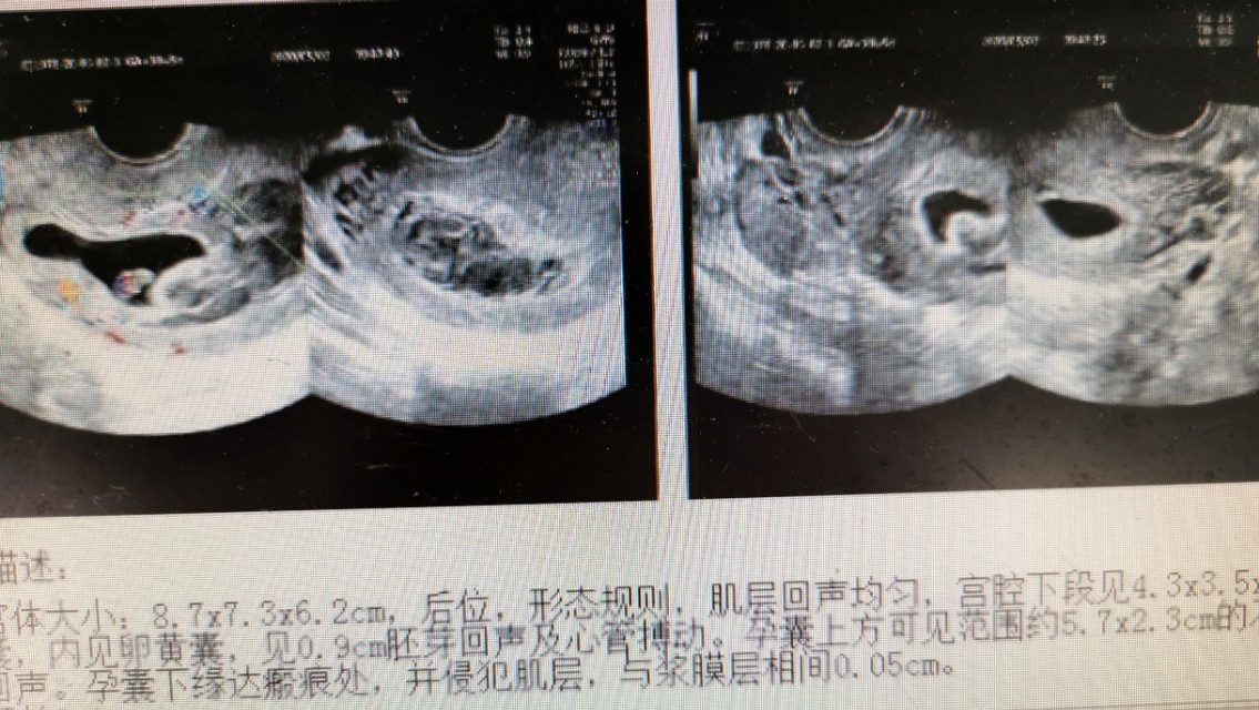 为了年轻的母亲--记一场发生在节日午夜的跨院抢救
