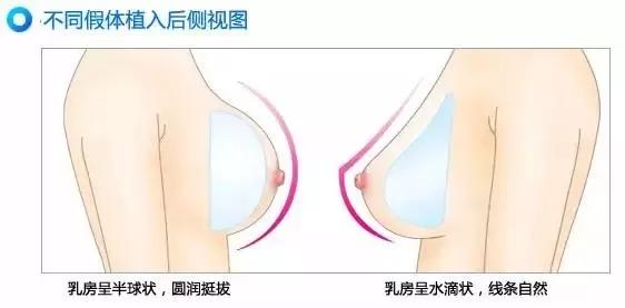 女生运动瘦不下来,女人运动瘦不下来怎么回事