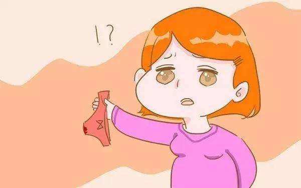 妇科阴道出血常见症状,阴道不规则流血症状