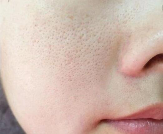 我的皮肤偏干性该怎么办,敷面膜皮肤还是干