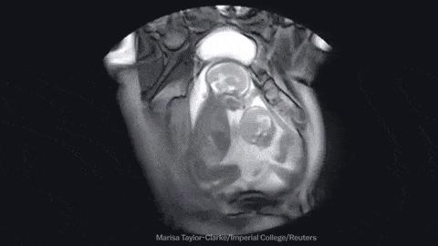 农场里走出CT鼻祖，美苏核危机诞生磁共振