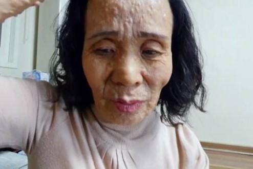 脸上长纤维瘤,父亲出走母亲改嫁,只剩弟弟却也车祸,我:做直播