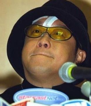 凌晨2点30分曾志伟遭毒打，缝29针几乎没命，隔月容祖儿被带警局