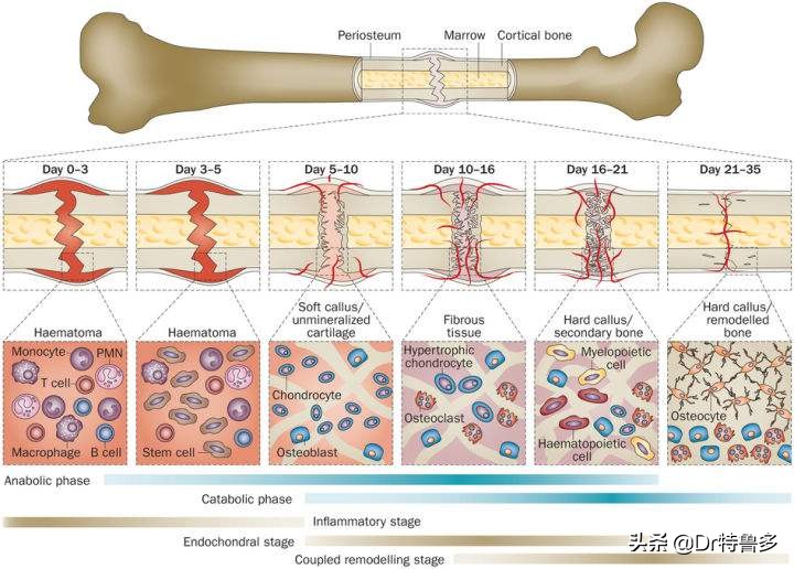 骨折了不长、长得慢怎么办？试试冲击波治疗吧