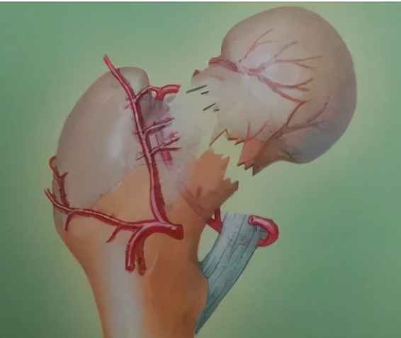 骨折术后为什么总是不舒服,骨折术后为什么有的人不愈合