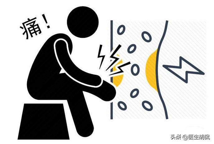 肾的什么问题会引起腰痛,什么症状腰痛是肾不好引起的