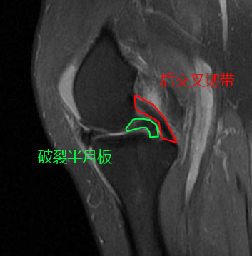 热爱舞蹈的老阿姨,热爱跳舞的阿姨
