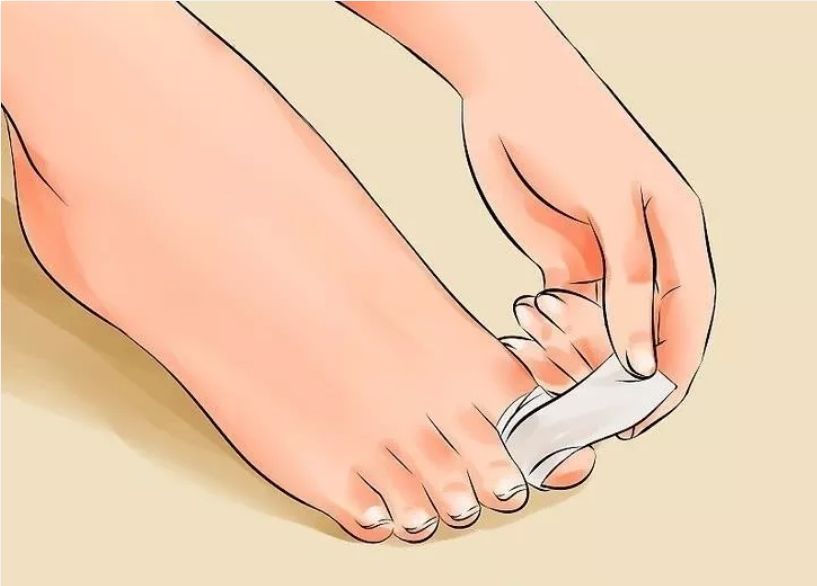 宝宝脚趾甲长到肉里怎么办,宝宝的脚趾总是弯着