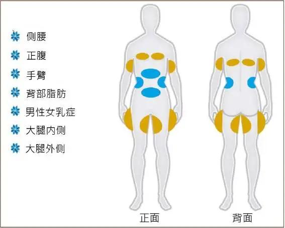 酷塑冷冻减脂可以减哪些地方,酷塑冷冻减肥效果