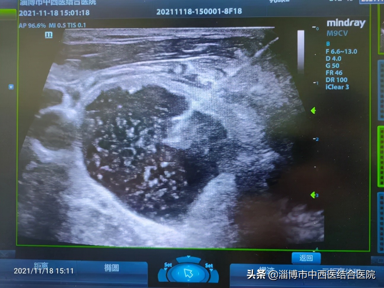 中西医结合中西合璧,中西结合中西合璧