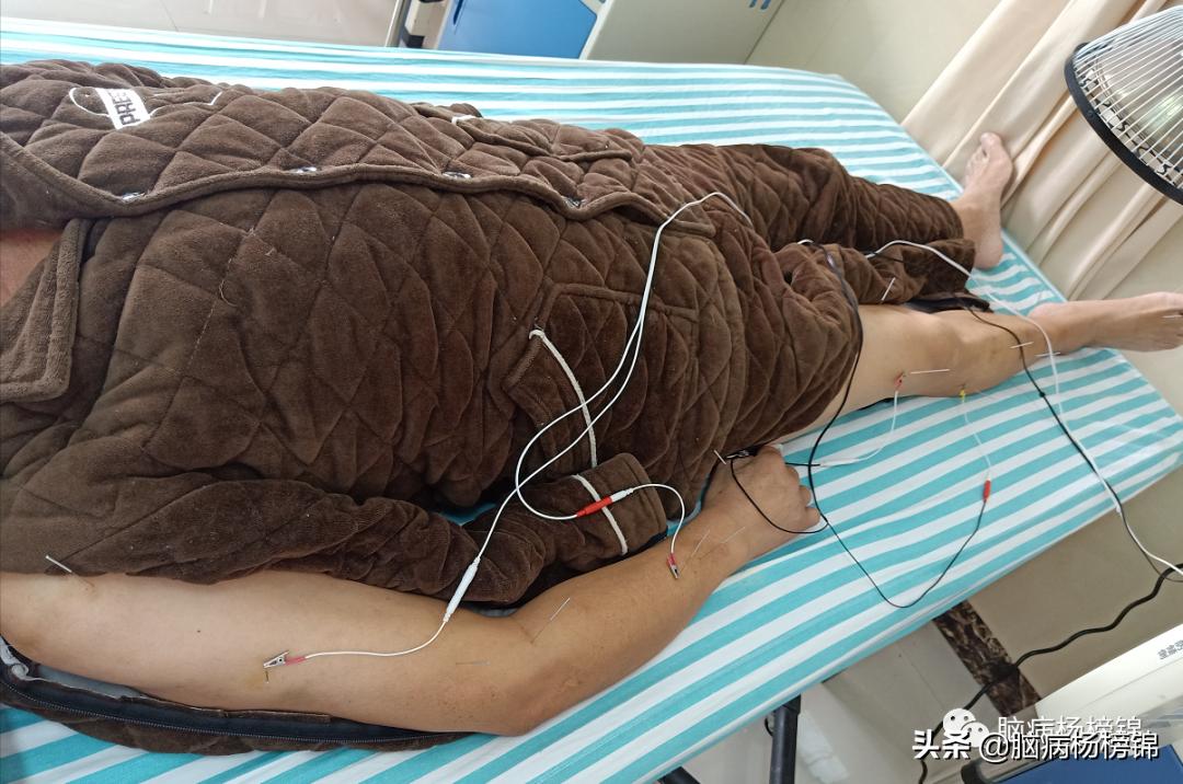 高处坠落4-6小时导致脑出血,高空作业会不会引起脑出血