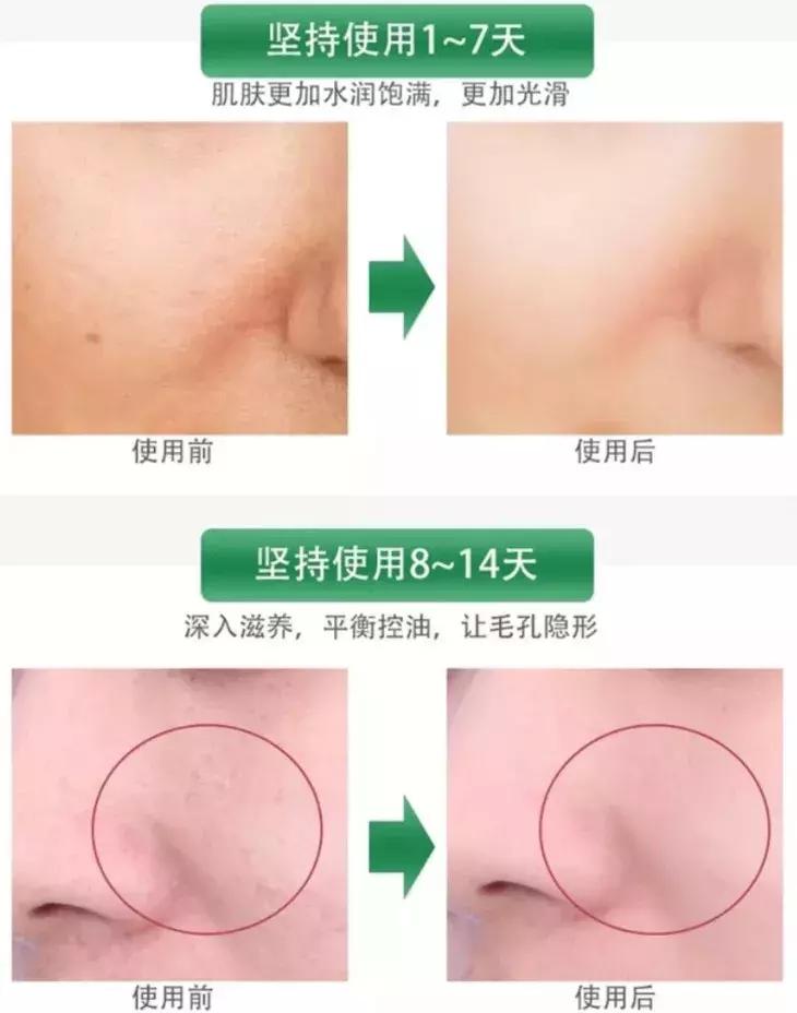 蜜梨六胜肽面霜李佳琦,日本蜜梨面霜李佳琦