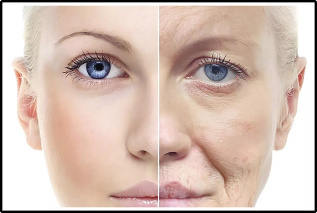 法令纹贴能消除法令纹吗,法令纹贴是怎样去除法令纹的