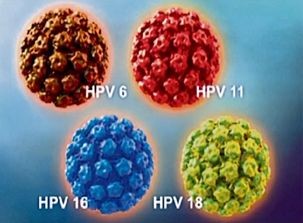 感染hpv病毒多久会形成宫颈癌,hpv病毒可以打宫颈癌疫苗防御么