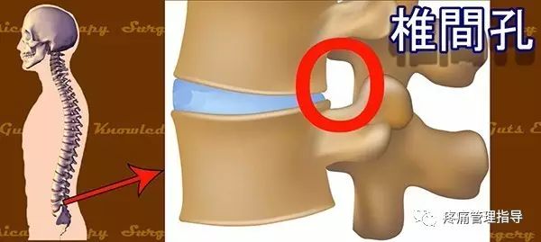 72岁老人腰疼还有骨刺该怎么治疗,老年人骨刺疼痛怎么治疗