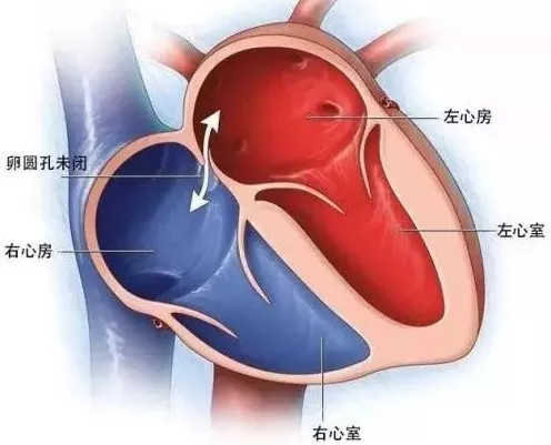 儿童买重大疾病保险有必要吗,有先天性疾病购买哪种保险合适