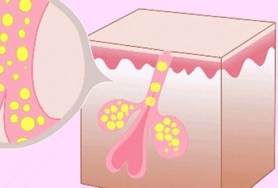 宋威龙、赵露思皮肤管理失败?毛孔粗大怎么办-四步改善毛孔粗大