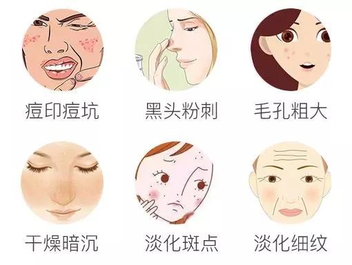 微针感受,微针真的很疼吗