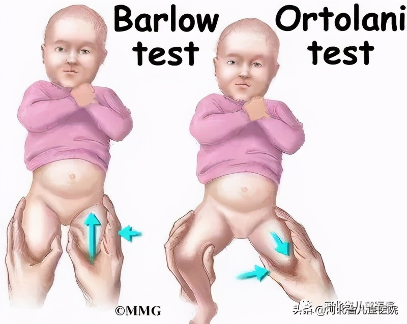 腿纹不对称家长千万别忽视,腿纹深浅不一样算不对称吗