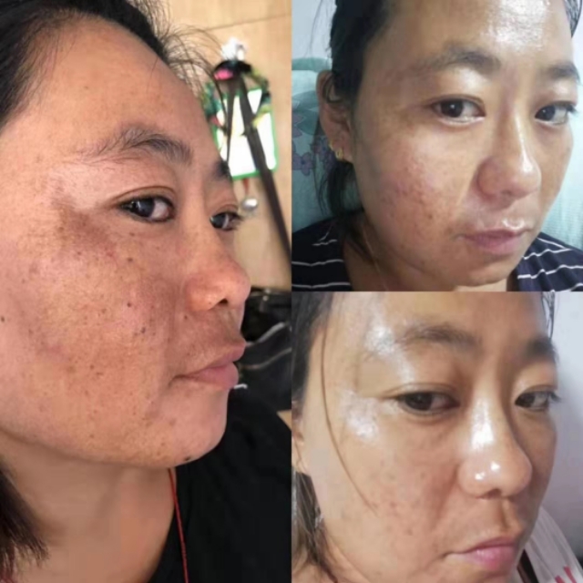 奢悦美白淡斑套盒正品,奢悦美白淡斑套盒200元