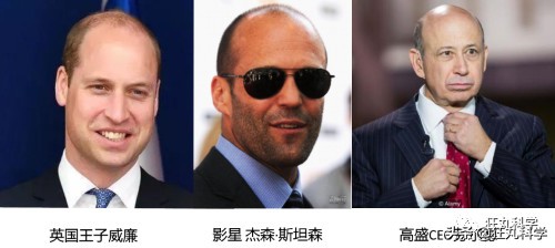 研究秃头30年后,日本老教授用复读机的方式解答脱发问题