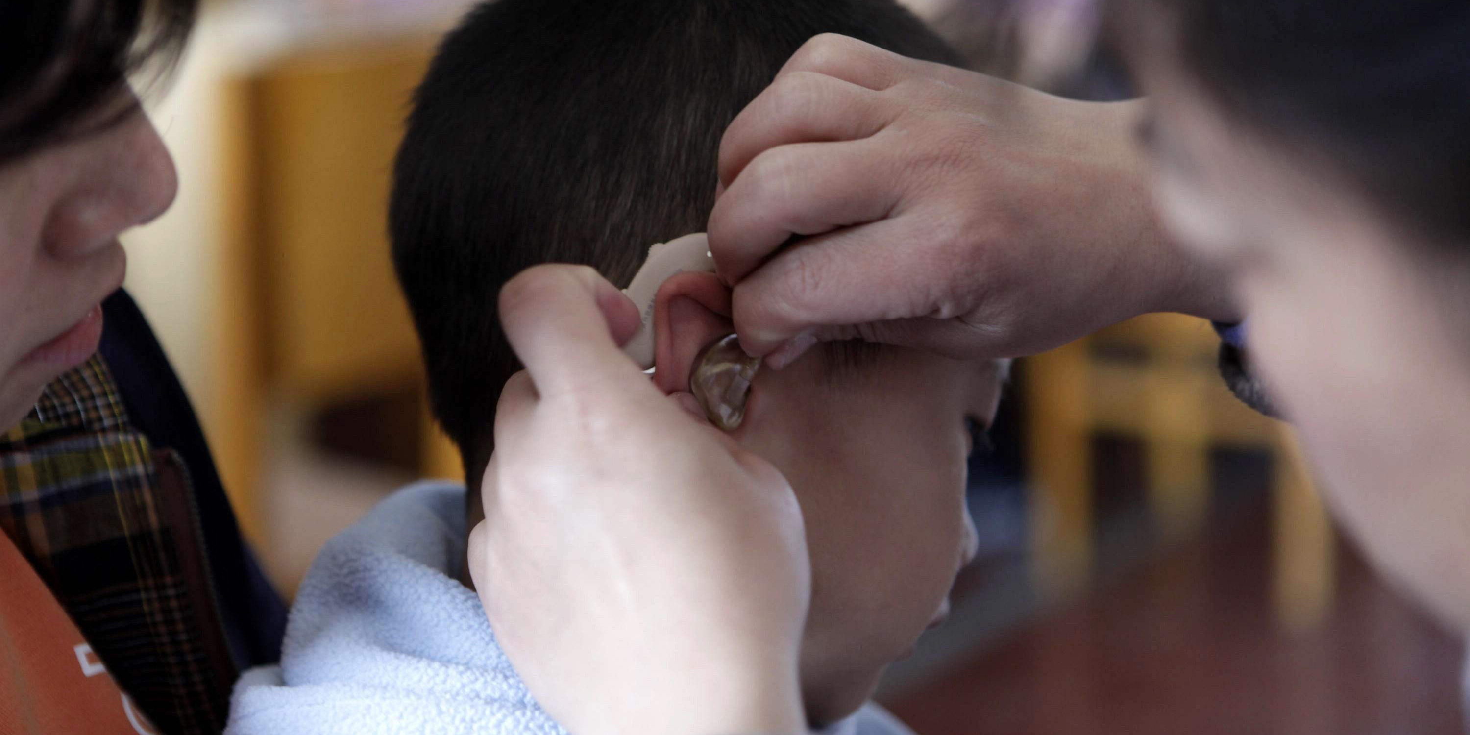 儿童用什么药不当致聋,什么药物可以导致儿童耳聋