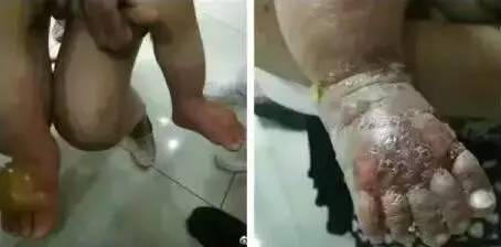 这些儿童用药误区一定要避开,儿童用药五大误区家长请注意