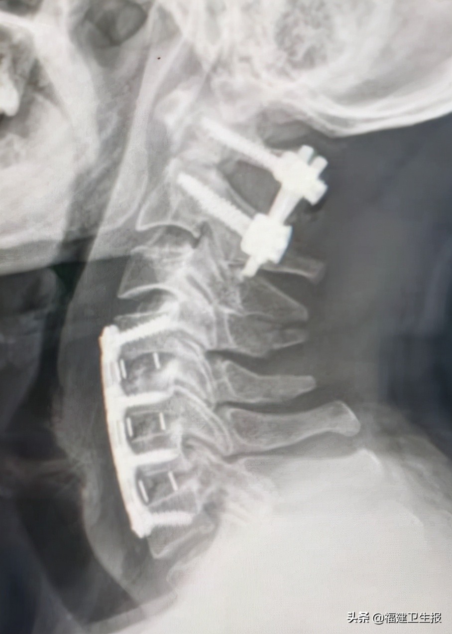 娉夊窞绗竴鍖婚櫌棰堟鎵嬫湳,娉夊窞鍖婚櫌棰堟寰垱