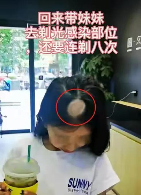 女孩儿养猫十天变秃头,养猫怎么防止得猫癣