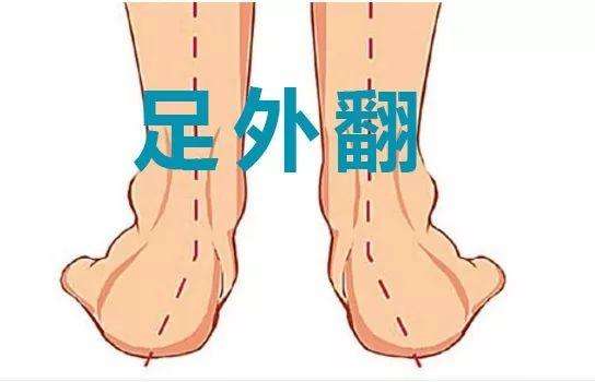 膝外翻的判定方法,足外翻导致膝外翻的最佳锻炼方法