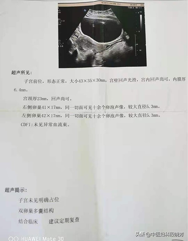 「看诊日常」一个月来两次月经，我是不是不太正常？