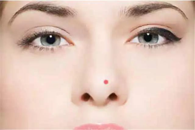 眨眼睛面部肌肉跟着动是什么原因,面部三叉神经痛是什么原因造成的